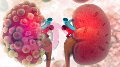 أقراص كرانبري CRANBERRY لعلاج الالتهابات في المسالك البولية