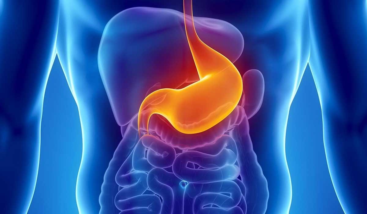 تجربتي في علاج قرحة المعدة