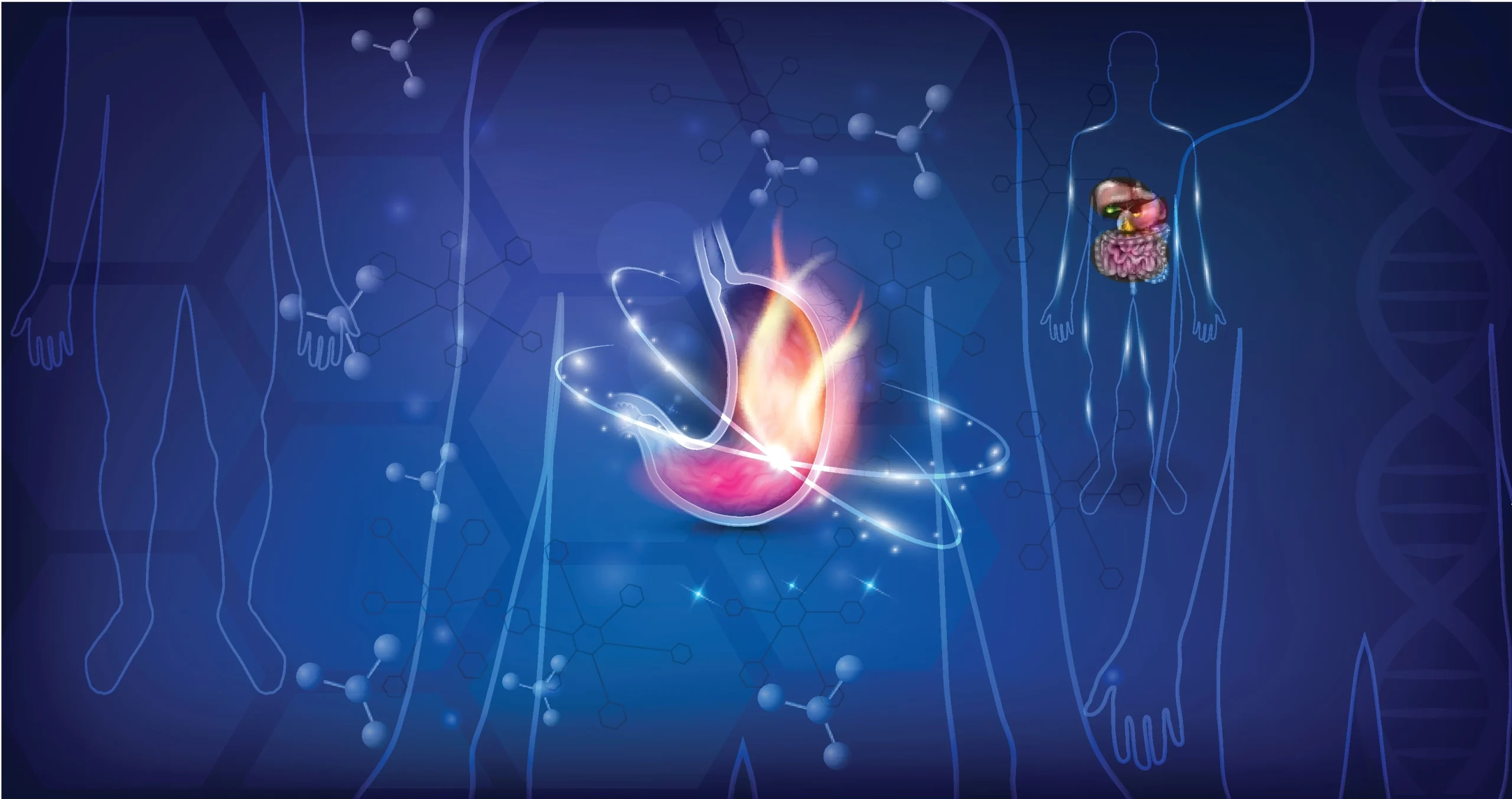 تجربتي في علاج قرحة المعدة