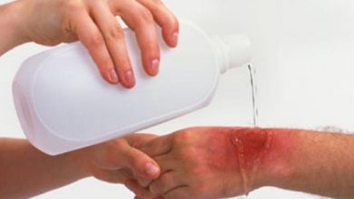 مرهم سِيكناترا Skِinatra لعلاج الجروح