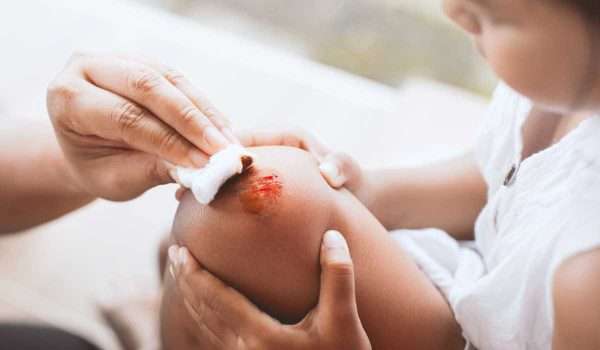 مرهم سِيكناترا Skِinatra لعلاج الجروح