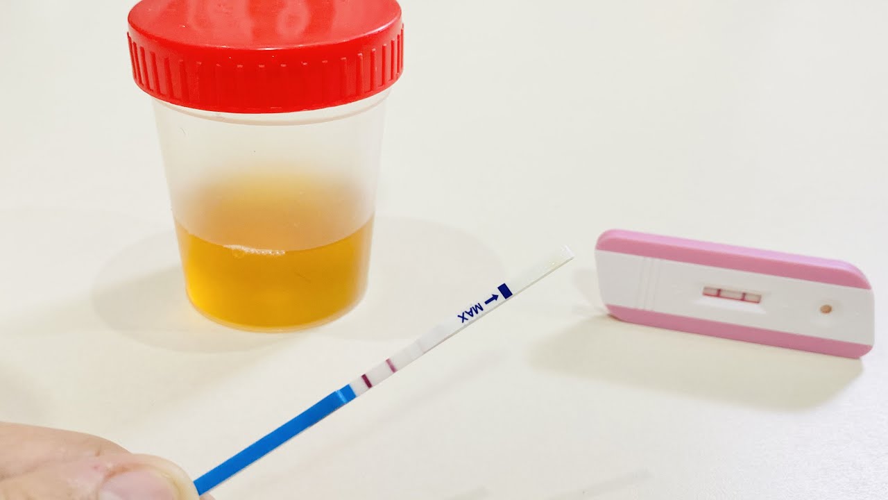 متى يظهر الحمل في اختبار البول