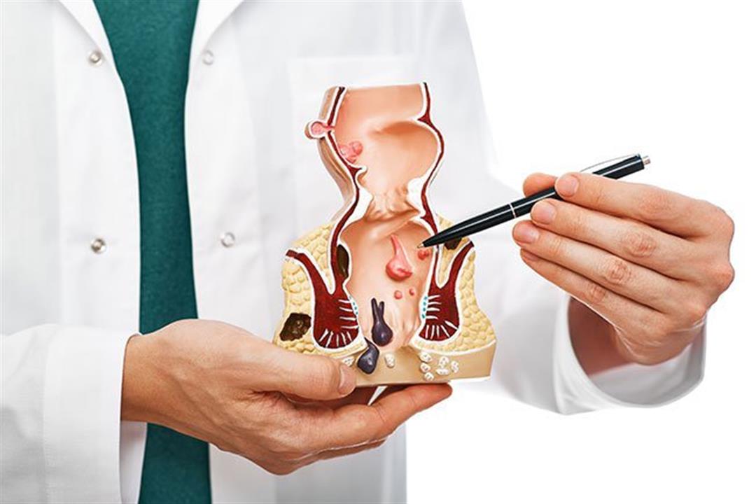 من جربت تحاميل بروكتو جليفنول ودواعي الاستعمال والفوائد والأضرار